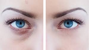 Eye bags are the swelling or puffiness under the eyes which happens due to weakening of tissues the most important and number one on the how to get rid of eye bags list is sufficient sleep. How To Remove Eye Bags In Photoshop Youtube