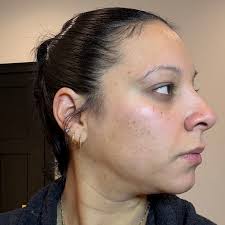 c o n s i s t e n c y = r e s u l t s Skin transformation doesn't happen  overnight