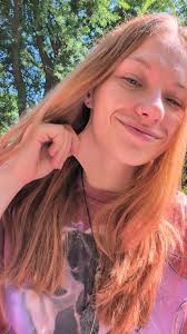 Is this skin excessively stretchy?