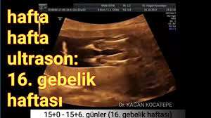 We have a large and every day growing universe of video clips this video has been updated on january 2021.you can watch and free download bebeğin cinsiyeti en erken ne zaman belli olur video from this site. 16 Gebelik Haftasinda Anne Karnindaki Kiz Bebek Aciklamali Ultrason Goruntuleri Youtube