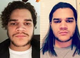 Growing Curly Hair Through The Awkward Stage