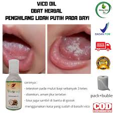 Tak hanya itu, biasanya pertambahan berat badan si bayi setiap. Obat Lidah Putih Pada Bayi Original Bpom Obat Jamur Pada Lidah Bayi Vico Oil Sr12 Obat Herbal Bagi Kesehatan Bayi Lazada Indonesia