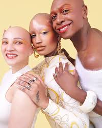 3 Stories of Going Bald & Embracing Life Without Hair