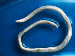 Vers Intestinaux Causes Et Traitements Sciences Et Avenir