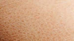 Jun 15, 2021 · manfaat baby oil untuk kecantikan yang jarang diketahui adalah dapat mencegah rambut menjadi kering. Kulit Kering Ini 5 Penyebabnya Analisa Aceh