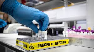 His mom stephanie franek, 44, had taken him to hospital two days earlier after his nailbeds turned blue and he struggled to talk easily. Coronavirus Two Healthy Teens 13 And 19 Die In London Uk News Sky News