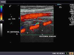 A Gallery Of High Resolution Ultrasound Color Doppler 3d Images Vascular Medical Ultrasound Vascular Ultrasound Vascular