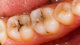 Zahnaerzte Hh Regelmassig Vorsorgen