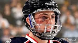 Columbus blue jackets defenseman zach werenski is a tough kid. Sports And Acl Injuries Hockey Lacerations Life In The Nhl