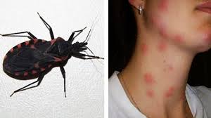 Dia Mundial da Doenças de Chagas, que mata 12 mil pessoas todos os anos -  PORTAL MATO GROSSO