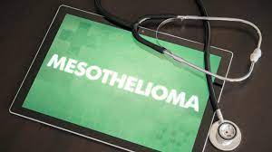 Your doctor can provide information on malaria disease preve. Cure May Be On The Horizon For Mesothelioma Israel21c