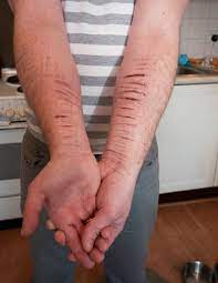 Express something that is hard to put into words turn invisible thoughts or feelings into something visible Prevention Of Self Harm In Adolescents The Bmj