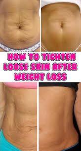 The Best Bodybuilding Workouts Program Workout Plan For Beginners Tighten Loose Skin Skin Tightening Stomach Excess Skin