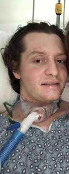 Man, 36, Details Recovery from Locked-In Syndrome (Exclusive)