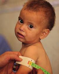 Experiences of the 'Whole of Syria' coordination for nutrition