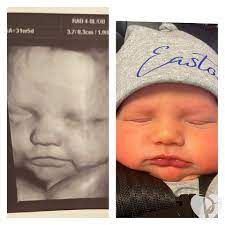 Easton Gregory Has Made My Baby You Ll Be 4d Ultrasound Facebook