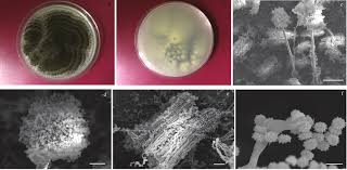 The fungi is most commonly found in mesophilic environments such as decaying vegetation or soil and plants. Aspergillus Niger Morphology A B Colonies On Pda A Top View Of The Download Scientific Diagram