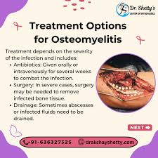 Image result for Osteomyelitis Management