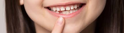 What happens to your teeth when you get permanent teeth? When Do Permanent Teeth Develop In Children Charlotte Pediatric Dentistry The Best Pediatric Dentist In Charlotte Davidson Gastonia And Uncc Area