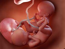 Pernahkan anda terfikir bagaimana agaknya rupa perkembangan bayi berlaku dalam kandungan seorang ibu selama 40 minggu ? Foto Perkembangan Bayi Kembar Di Dalam Rahim Ibu Hamil Kumparan Com