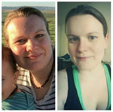 Here Is Michaela S Before And After And It S The After That Tells The Story With Hashimotos She S Now On 270mg Of Hypothyroidism Best Cardio Workout Thyroid
