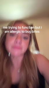 What Do Pincher Bug Bites Look Like