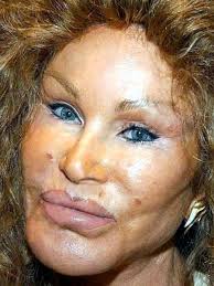 We talk to a woman who had a nose job to find out what it's really like to get plastic surgery. Igor And Grichka Bogdanoff Extreme Plastic Surgery Disasters And Why They Do It News Com Au Australia S Leading News Site