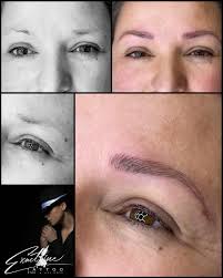 Exact Line Pigmentation's