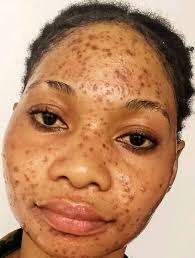 Character skin recommendation for rectifier