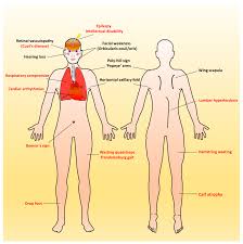 Existing uses possible future uses reading: Ijms Free Full Text Early Onset Infantile Facioscapulohumeral Muscular Dystrophy A Timely Review Html