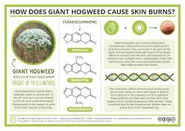 Giant Hogweed Skin Burns Chemistry Teaching Chemistry Chemistry Education Chemistry