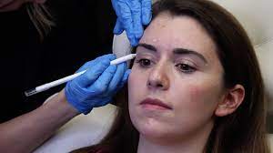 In some cases, the results of treatment last far longer than six months. 4 Things To Expect For First Time Botox Injections Your Wellness Center