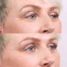 Maybe you would like to learn more about one of these? Trinny London Miracle Blur Lip And Line Filler