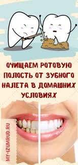 что можно сделать от зубной боли в домашних условиях Ochishaem Rotovuyu Polost Ot Zubnogo Naleta V Domashnih Usloviyah Healthy Teeth Health Fitness Health