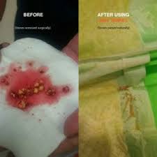 Before After Photos Of Kidney Stones In Dogs Notice How They Got Smaller And Passed Out Naturally After Using Nhv Kidney Stones Remedy Pet Remedies Cat Kidney