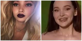 Dove Cameron Plastic Surgery: Did It Happen?