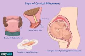 Image result for cervix position