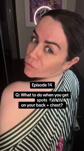 Spots below the jawline? We get it! That’s why I created in the  Skingredients family Miss Sally Cleanse your go-to spot zapper for face and  body! This multi award winner, with the 2% salicylic acid ...