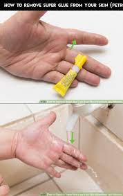 Index Of Remove Super Glue Super Glue Skin