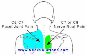 Pin On Back Pain