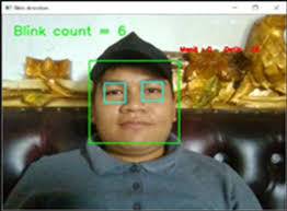 Binking Application: Early Detection of Computer Vision Syndrome