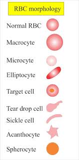 Complete Blood Count Cbc Part 2 Red Blood Cells Morphology And Interpretation Labpedia Net