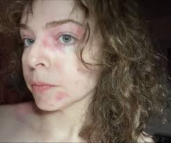 For about a month or so now I have been experiencing extreme body  temperature irregularities. I feel like I am constantly cold but I am  always sweating even when i'm comfortable. My