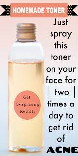Homemade Toner For Acne Prone Skin Skin Skincaretips Toner Acne Clearskin Biooilskincareroutine Homemade Toner Diy Skin Toner Homemade Skin Toner