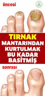 Gul Tamay Adli Kullanicinin Saglik Ve Spor Aktiviteleri Panosundaki Pin Saglik Mantar Saglik Urunleri