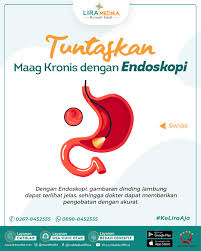 Maag kronis testimony kesembuhan gastritis atau maag kronis. Rs Lira Medika Penyakit Maag Yang Tidak Mendapatkan Facebook
