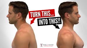 A neck hump is also known as a buffalo hump or a dowager's hump. Fix Neck Hump Fast With These Home Exercises Youtube