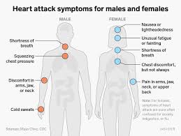 Furthermore, women are much more likely than men to experience angina when their coronary arteries appear completely normal during cardiac catheterization. Guide To Heart Disease Types Symptoms Causes And Treatment