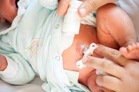 Akan tetapi, lilitan tali pusar bisa juga berdampak buruk pada kesehatan janin jika lilitan yang terjadi terlalu kencang. Bayi Terlilit Tali Pusar Penyebab Dan Pencegahannya