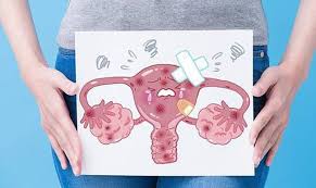 Apa itu human papillomavirus hpv). Pemeriksaan Hpv Dna Diagnos Clinical Laboratory